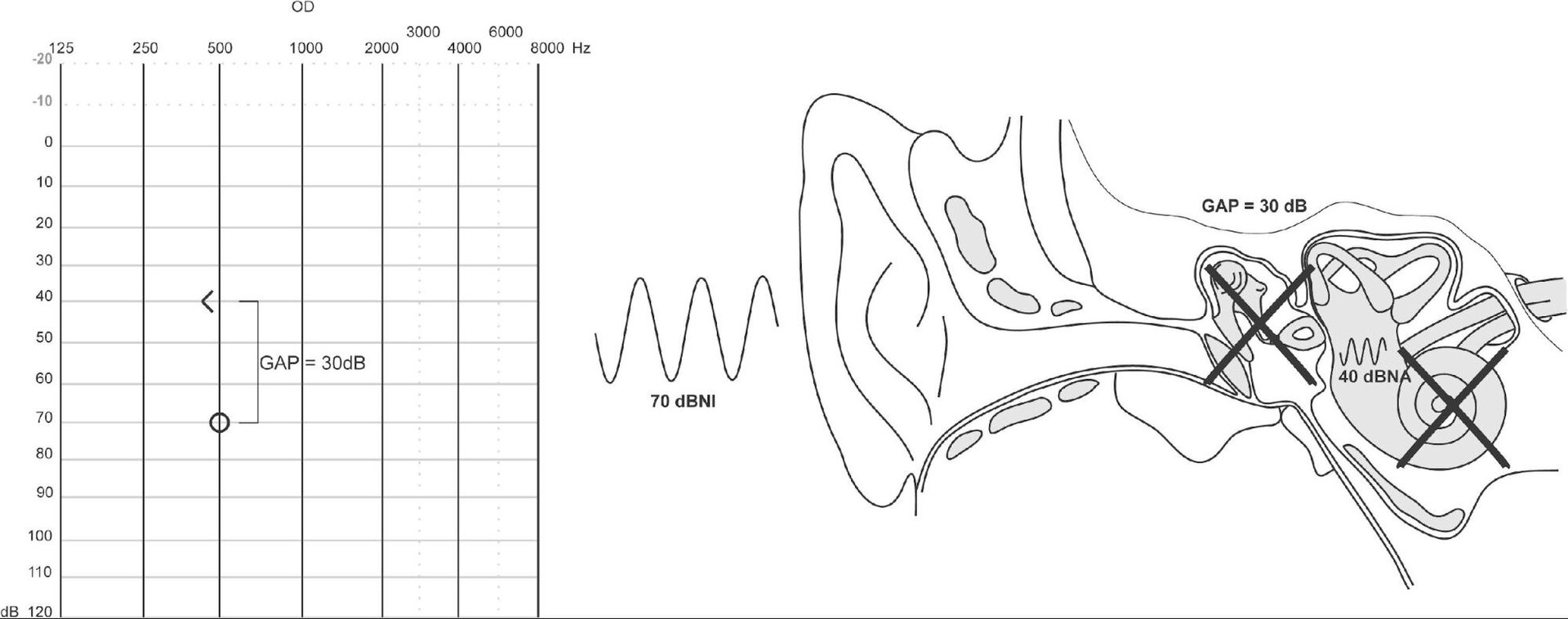 Imagem de referência de audição, descrito nos dados abertos como percepção sensorial do som por organismos vivos