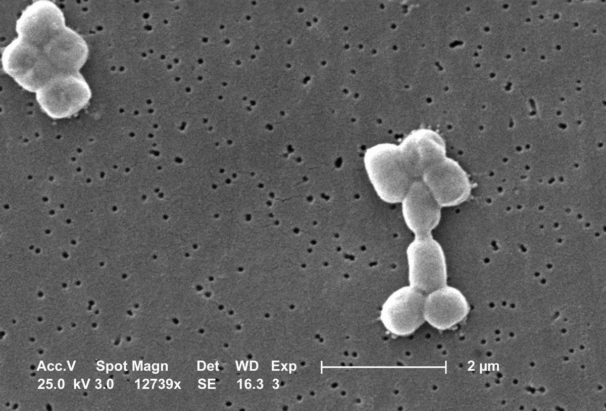 Imagem de referência de Acinetobacter baumannii, descrito nos dados abertos como espécie de bactéria