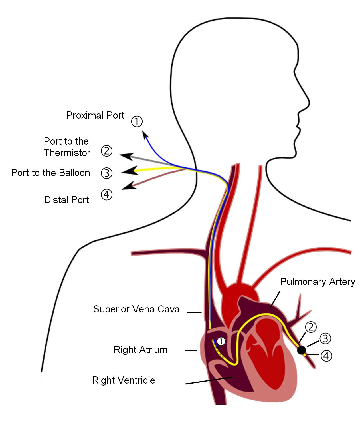 Imagem de referência de artéria pulmonar, descrito nos dados abertos como artéria da circulação pulmonar que transporta sangue desoxigenado do coração para os pulmões