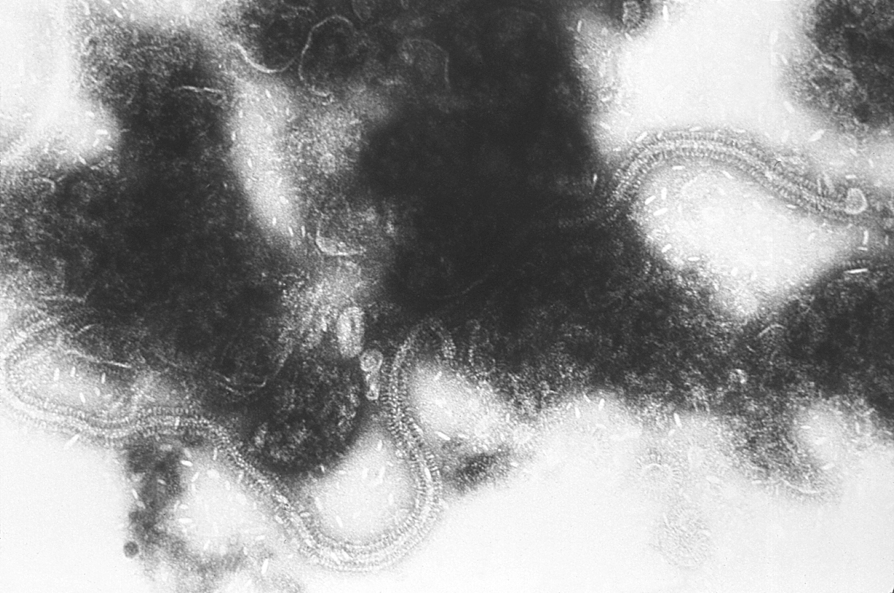 Imagem de referência de vírus sincicial respiratório, descrito nos dados abertos como vírus responsável por infecção respiratória