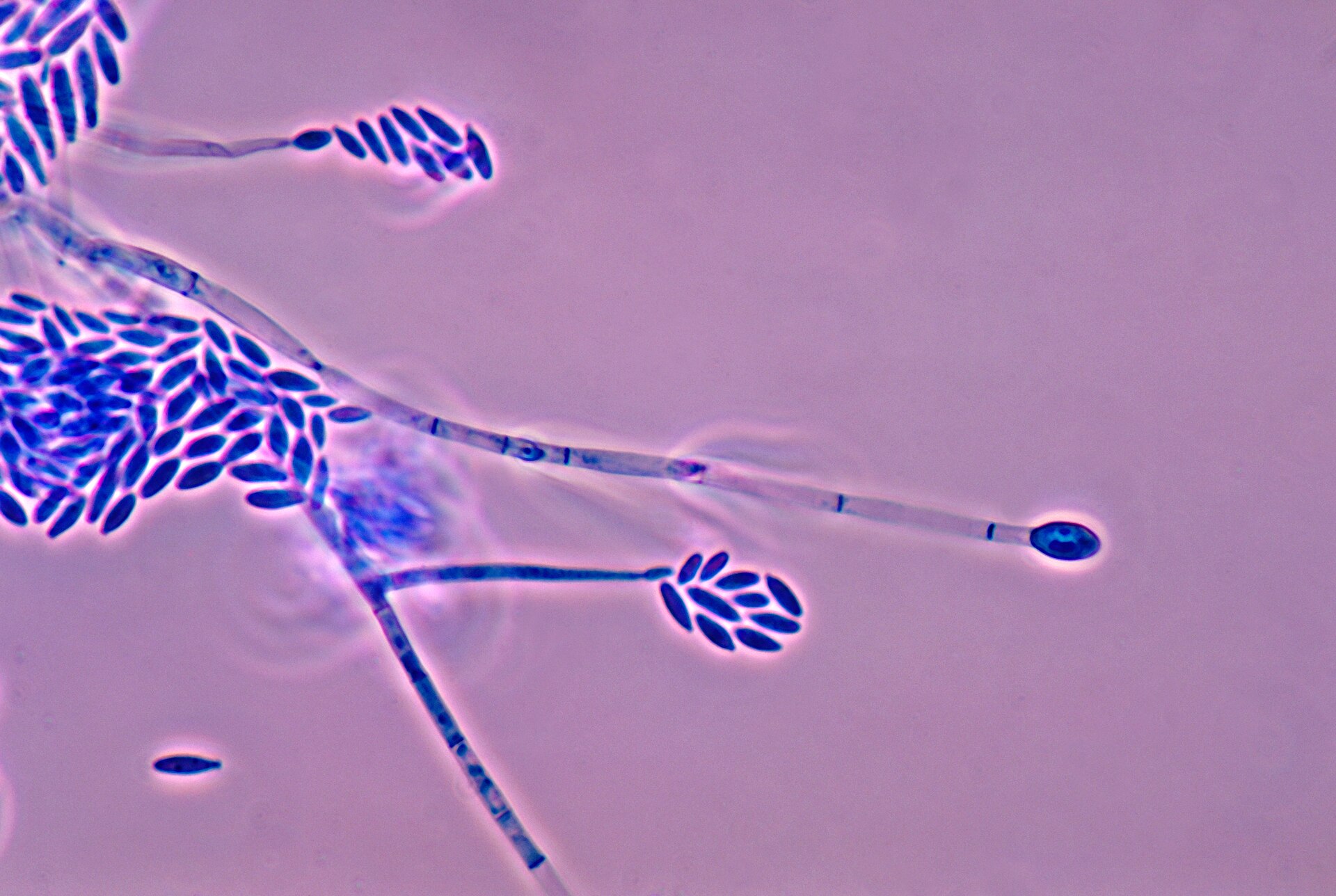 Imagem de referência relacionada a Fusarium, item descrito como género de fungos