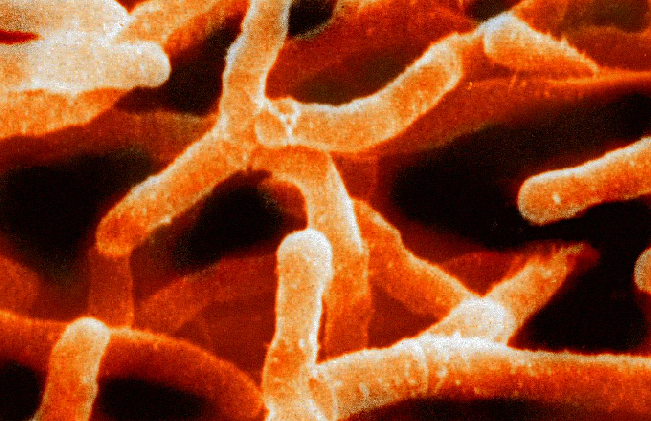 Imagem de referência relacionada a Actinobacteria, item descrito como registro de referência sobre Actinobacteria, organizado a partir de dados estruturados abertos