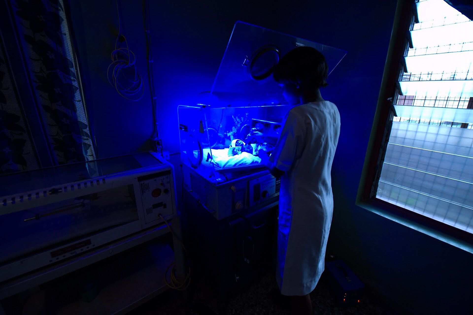 Imagem de referência de icterícia neonatal, descrito nos dados abertos como doença que afeta recém-nascidos
